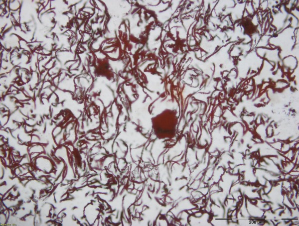 Microskopbilde